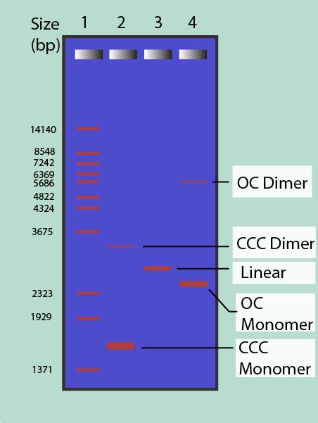interpretation of dna gel electrophoresis results|How to Read Gel Electrophoresis Bands: .